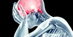 dealing with concussion, concussion, head trauma, headaches, 
